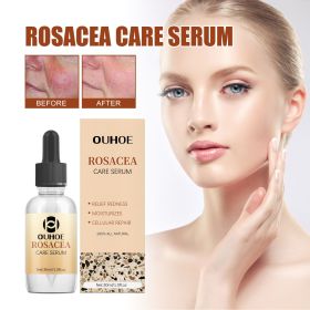OUHOE Erythematous Repair Essence, Repair Skin Lighten Facial Erythematous Moisturizing Essential Oil